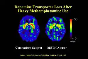 A neurobehavioral syndromic disorder