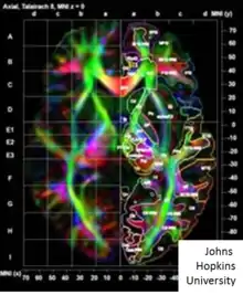 Image shows colored picture demonstrating orientations of fibers based on principle eigenvectors and eigenvalues of DTI matrices.