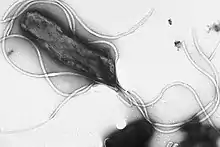 Helicobacter pylori electron micrograph, showing multiple flagella on the cell surface