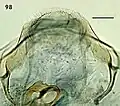 Female terminal abdominal segment