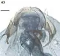 Female terminal abdominal segment