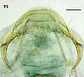 Female terminal abdominal segment