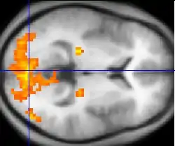 Monochrome fMRI image of a horizontal cross-section of a human brain. A few regions, mostly to the rear, are highlighted in orange and yellow.