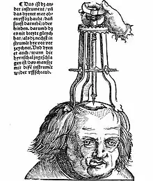 Behandlung einer Schädelwunde (Treatment of a skull injury)