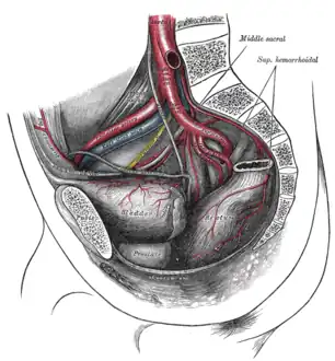 Bifurcation of the aorta and the right common iliac artery - side view.  (External iliac artery is artery at upper left, seen splitting from common iliac artery at top.)