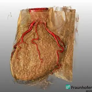 Heart rendered in MeVisLab