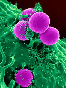 Scanning electron micrograph of a human neutrophil ingesting MRSA