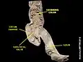 Ileum, cecum and ascending colon