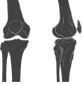 Anterior and lateral view of knee.