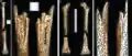 Burial 7. Perimortem fractures on long bones.