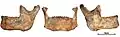 Burial 17 - The mandiblewas within the skullcap. Teeth were intentionally removed and burnt marks are limited to the alveolar margin.
