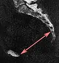 Low-dose CT scan of sagittal pelvic outlet diameter as part of pelvimetry