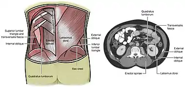 Lumbar triangle