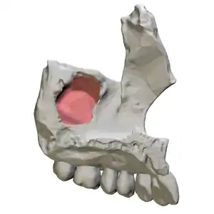 Maxillary sinus - medial view