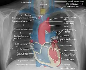 The outline of superior vena cava on a chest X-ray is labeled at left.