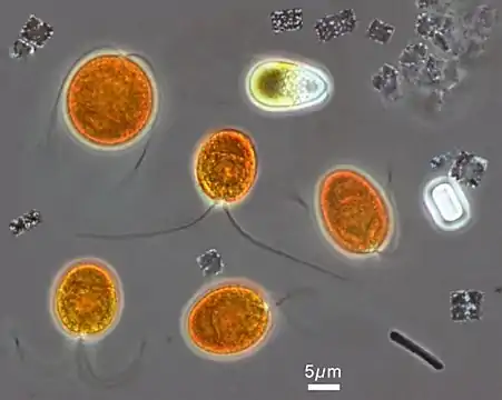 Microscopic image from the hypersaline Lake Tyrrell, in which orange chlorophyte Dunaliella salina can be tentatively identified, accompanied by a number of smaller Haloquadratum walsbyi, showing their flat square-shaped cells.