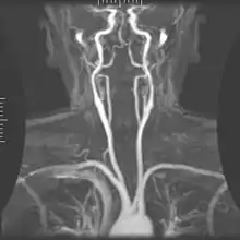 Arteriogram of the arterial supply.