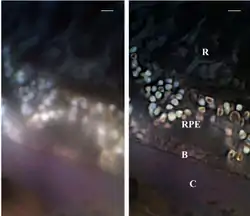 SMI Investigation of human eye tissue, affected by macular degeneration AMD