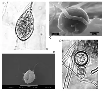 Water mould - Phytophthora forms: A: Sporangia. B: Zoospore. C: Chlamydospore. D: Oospore