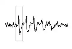 A jagged line with upward-downward deflections. A rectangular box surrounds one deflection.