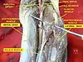 Plantaris muscle