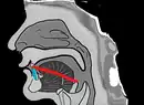 The shape of teeth and tongue when pronouncing ㅅ