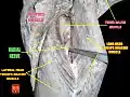 Radial nerve