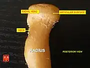 Posterior View. Radial tuberosity.