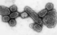 An electron micrograph of the virus that caused Spanish influenza