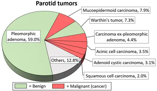 Relative incidence of parotid tumors, with adenoid cystic carcinoma being relatively rare.