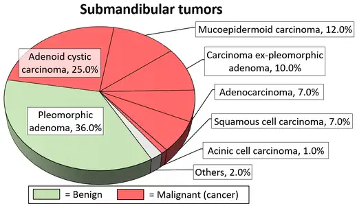 Relative incidence of submandibular tumors, showing carcinoma ex pleomorphic adenoma at top-right.