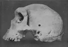 Image 23Skull of Broken Hill Man discovered in present-day Kabwe. (from History of Zambia)