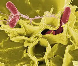 Color-enhanced scanning electron micrograph of red Salmonella typhimurium in yellow human cells