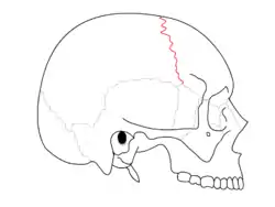 Coronal suture. It separates the parietal bones and the frontal bone.