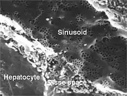 Scanning electron micrograph of a liver sinusoid with fenestrated endothelial cells.