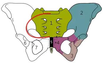 Pelvis with the iliopectineal line indicated in red