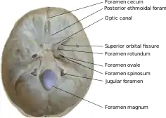 Photo with foramina of skull labeled.  Foramen cecum is labeled at the top right.