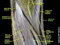 Gracilis muscle