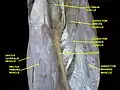 Muscles of Thigh. Anterior views