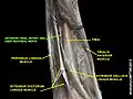 Anterior tibial artery