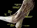 First metatarsal bone. Deep dissection.