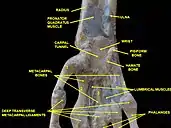 Wrist joint. Deep dissection.Anterior, palmar view