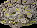 Cerebrum. Medial face. Deep dissection.