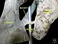 Pancreatic duct Deep dissection.Anterior view.