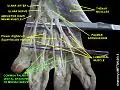 Common palmar digital branches of median nerve