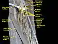 Femoral nerve.Deep dissection.