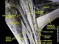 Basilic vein