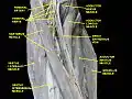 Femoral nerve.Deep dissection.