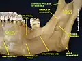 Coronoid process of mandible