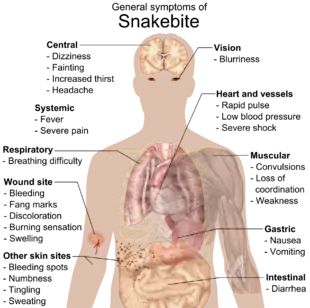 Image 38Most common symptoms of any kind of snake bite envenomation. Furthermore, there is vast variation in symptoms between bites from different types of snakes. (from Snake)